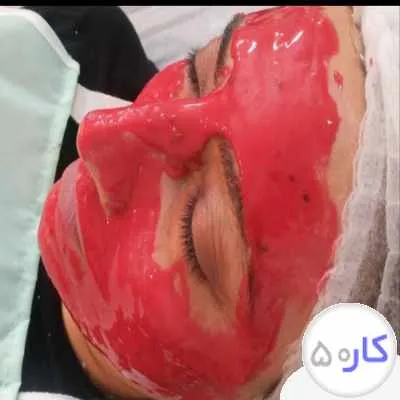 پاکسازی و جوانسازی پوست و مو و مزو و هایفو تراپی و خالبرداری