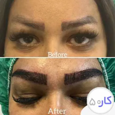 مدل جهت کاشت ابرو
