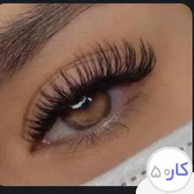 انجام کاشت موژه موقت کاملی هیدن گربه ای