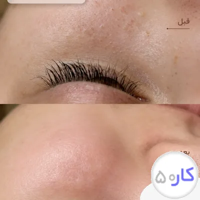 مرکز تخصصی میکرو ابرو و پاکسازی پوست عاطفه شاکری